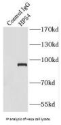 Hermansky-Pudlak Syndrome 4 Protein (HPS4) Antibody