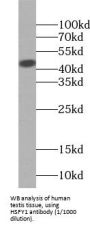 Heat Shock Transcription Factor, Y-Linked 1 (HSFY1) Antibody