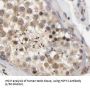 Heat Shock Transcription Factor, Y-Linked 1 (HSFY1) Antibody