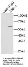 Heat Shock 60 kDa Protein 1, Chaperonin / HSP60 (HSPD1) Antibody