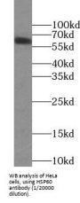 Heat Shock 60 kDa Protein 1, Chaperonin / HSP60 (HSPD1) Antibody