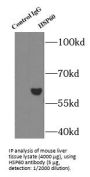 Heat Shock 60 kDa Protein 1, Chaperonin / HSP60 (HSPD1) Antibody