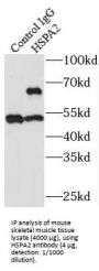 Heat Shock-Related 70 kDa Protein 2 (HSPA2) Antibody