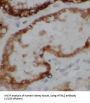Serine Protease HTRA2, Mitochondrial (HTRA2) Antibody