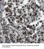 Hyaluronidase-2 (HYAL2) Antibody