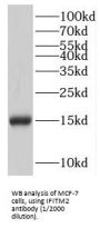 Interferon Induced Transmembrane Protein 2 (IFITM2) Antibody