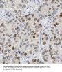 Interferon Induced Transmembrane Protein 2 (IFITM2) Antibody