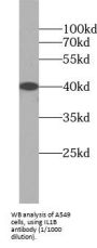 Interleukin-1 Beta (IL1B) Antibody