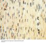 Interleukin-1 Beta (IL1B) Antibody