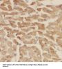 Acetolactate Synthase Like Protein (ILVBL) Antibody