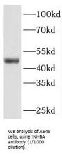 Inhibin Beta A (INHBA) Antibody
