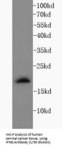 Interferon Gamma (IFNG) Antibody