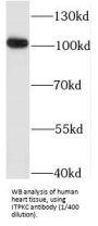Inositol-Trisphosphate 3-Kinase C (ITPKC) Antibody