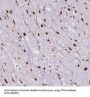 Inositol-Trisphosphate 3-Kinase C (ITPKC) Antibody