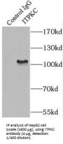 Inositol-Trisphosphate 3-Kinase C (ITPKC) Antibody