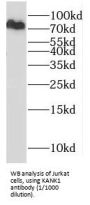 KN Motif And Ankyrin Repeat Domain Containing Protein 1 (KANK1) Antibody