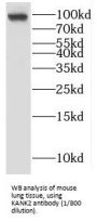 KN Motif And Ankyrin Repeat Domain Containing Protein 2 (KANK2) Antibody