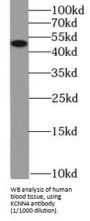 Potassium Intermediate/Small Conductance Calcium-Activated Channel, Subfamily N, Member 4 (KCNN4) Antibody