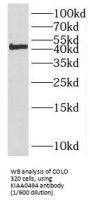KIAA0494 (EFCAB14) Antibody