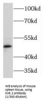 ATP-Sensitive Inward Rectifier Potassium Channel 12 (KCNJ12) Antibody