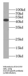 KISS1R-Specific Antibody