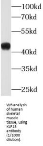 Krueppel-Like Factor 15 (KLF15) Antibody