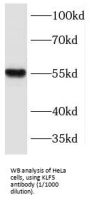 Krueppel-Like Factor 5 (KLF5) Antibody