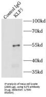 Krueppel-Like Factor 5 (KLF5) Antibody