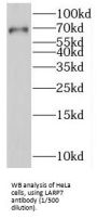La Ribonucleoprotein Domain Family, Member 7 (LARP7) Antibody
