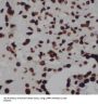 La Ribonucleoprotein Domain Family, Member 7 (LARP7) Antibody