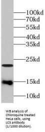 Microtubule-Associated Proteins 1A/1B Light Chain 3A (MAP1LC3A) Antibody