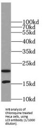 Microtubule-Associated Proteins 1A/1B Light Chain 3A (MAP1LC3A) Antibody