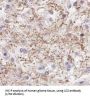 Microtubule-Associated Proteins 1A/1B Light Chain 3A (MAP1LC3A) Antibody