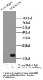 Microtubule-Associated Proteins 1A/1B Light Chain 3A (MAP1LC3A) Antibody