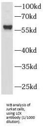Proto-Oncogene Tyrosine-Protein Kinase LCK (LCK) Antibody