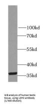 LDHC-Specific Antibody