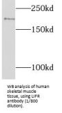 Leukemia Inhibitory Factor Receptor Alpha (LIFR) Antibody