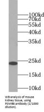 Proteasome Subunit Beta Type 8 (PSMB8) Antibody