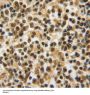 Proteasome Subunit Beta Type 8 (PSMB8) Antibody