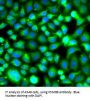 Proteasome Subunit Beta Type 8 (PSMB8) Antibody