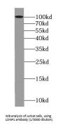 Lon Protease Homolog, Mitochondrial (LONP1) Antibody