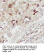Lon Protease Homolog, Mitochondrial (LONP1) Antibody
