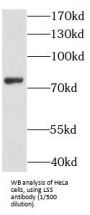 Lanosterol Synthase (LSS) Antibody