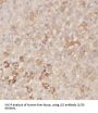 Lanosterol Synthase (LSS) Antibody