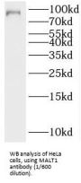 Mucosa-Associated Lymphoid Tissue Lymphoma Translocation Protein 1 (MALT1) Antibody