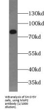 Microtubule Associated Protein 2 (MAP2) Antibody