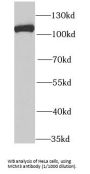 Minichromosome Maintenance Deficient 3 (MCM3) Antibody