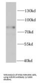 Methyl-CpG Binding Protein 2 (MECP2) Antibody
