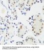 Methyl-CpG Binding Protein 2 (MECP2) Antibody
