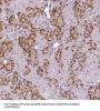 Meis Homeobox 2 (MEIS2) Antibody